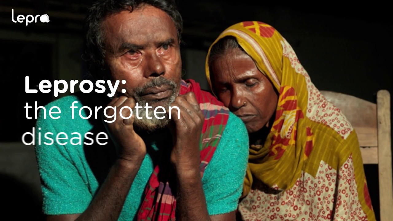 Lepra 1080P V3