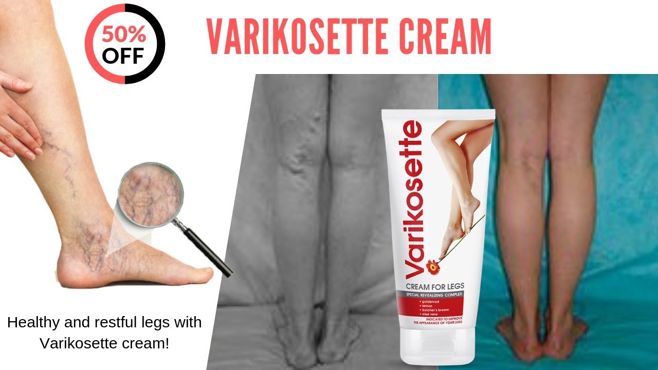 Varikosette Cream for legs-2019 -- Cyprus, Greece - YouTube