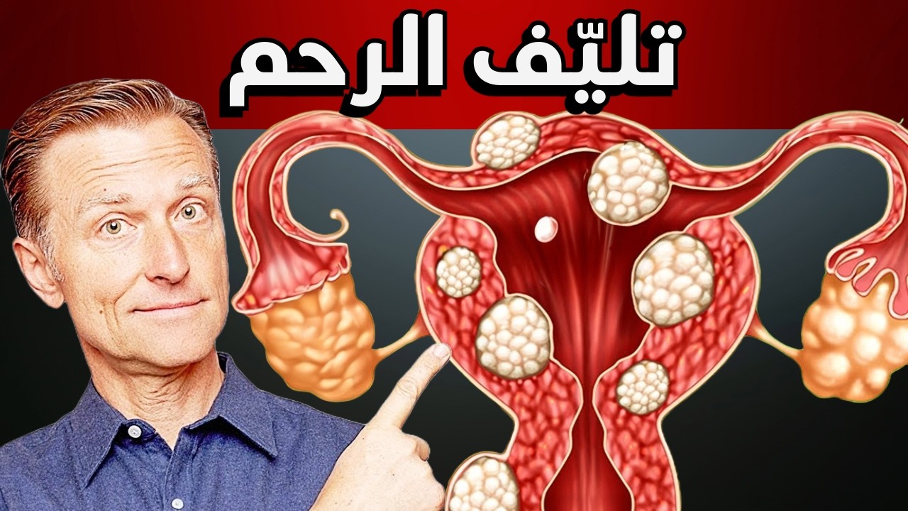 نصف النساء لديهن ورم ليفي أو تليف الرحم | السبب والعلاج الحقيقي
