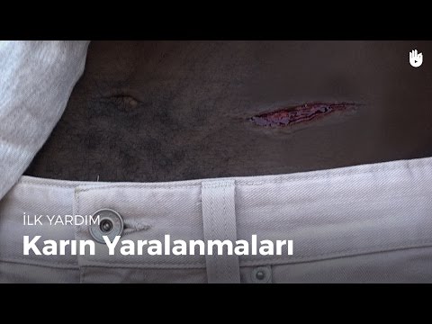 Video: İlk Yardım Sırasında Omurilik Yaralanmasını Önlemenin 3 Yolu