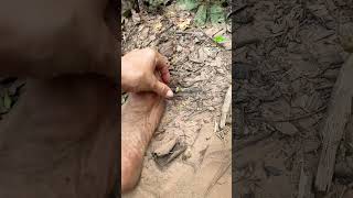 The Hidden Dangers of Walking Barefoot in the Amazon