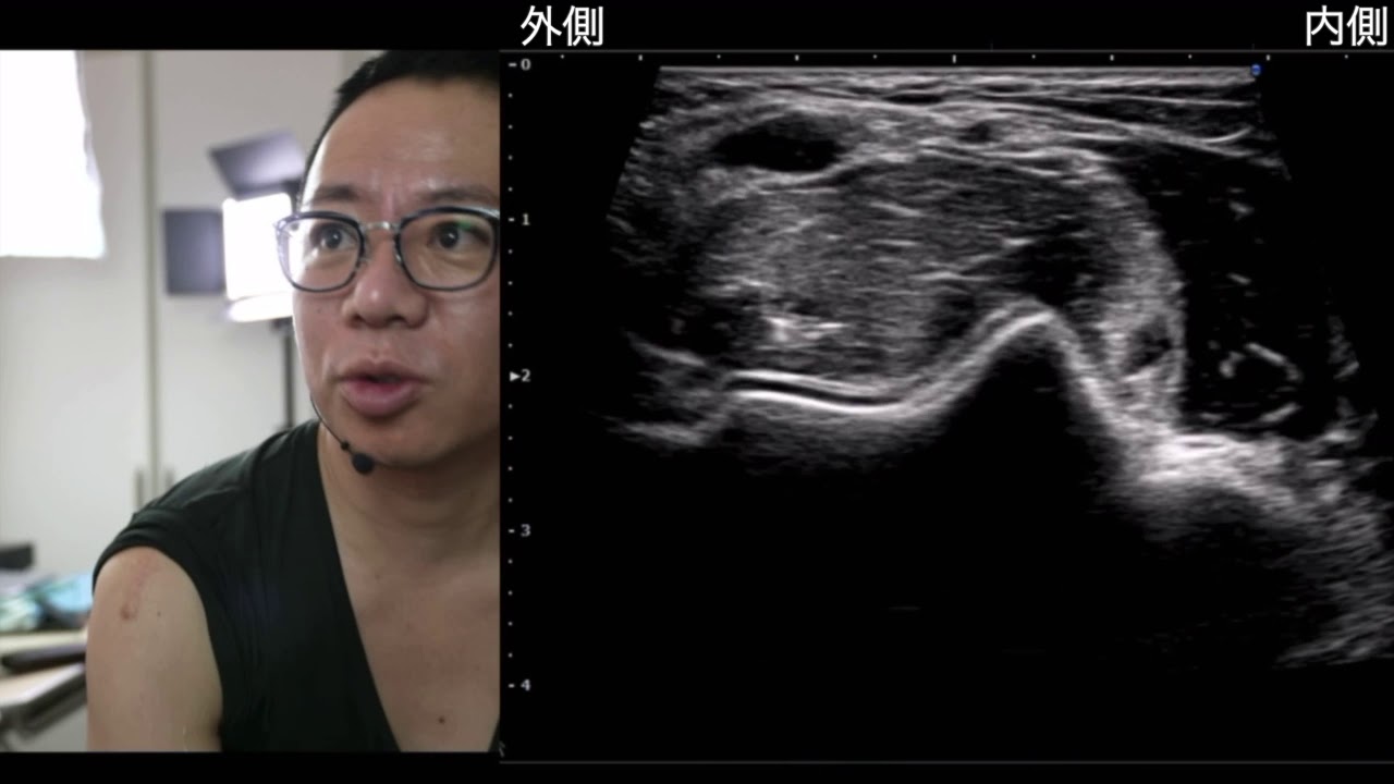 正中神経〜腋窩から手首まで〜