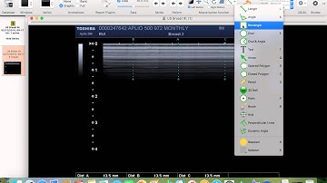 6  How to Remove Patient Data from US Series in Osirix