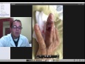 follow up on finger infection video