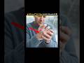 Why Does Our Skin Crack in Winter? | Science Explained #shorts #viral #118