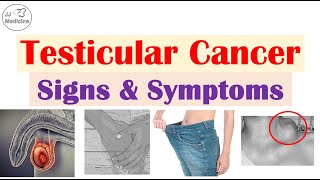 Testicular Cancer Signs and Symptoms, Risk Factors & Metastases
