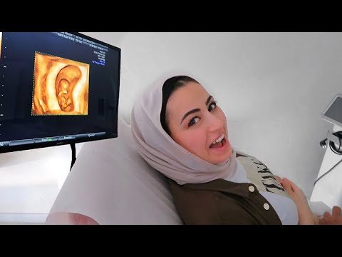 فيديو: تزوجت يوليا ميلوسلافسكايا زوجة عبدوف