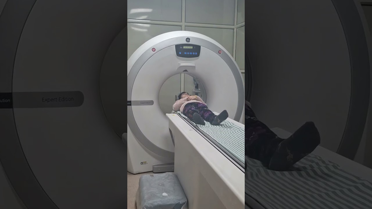 HEAD POSITION 5 YEAR BABY.#anatomy #medicalimaging #studytips #medicalimaging #doctor #students.