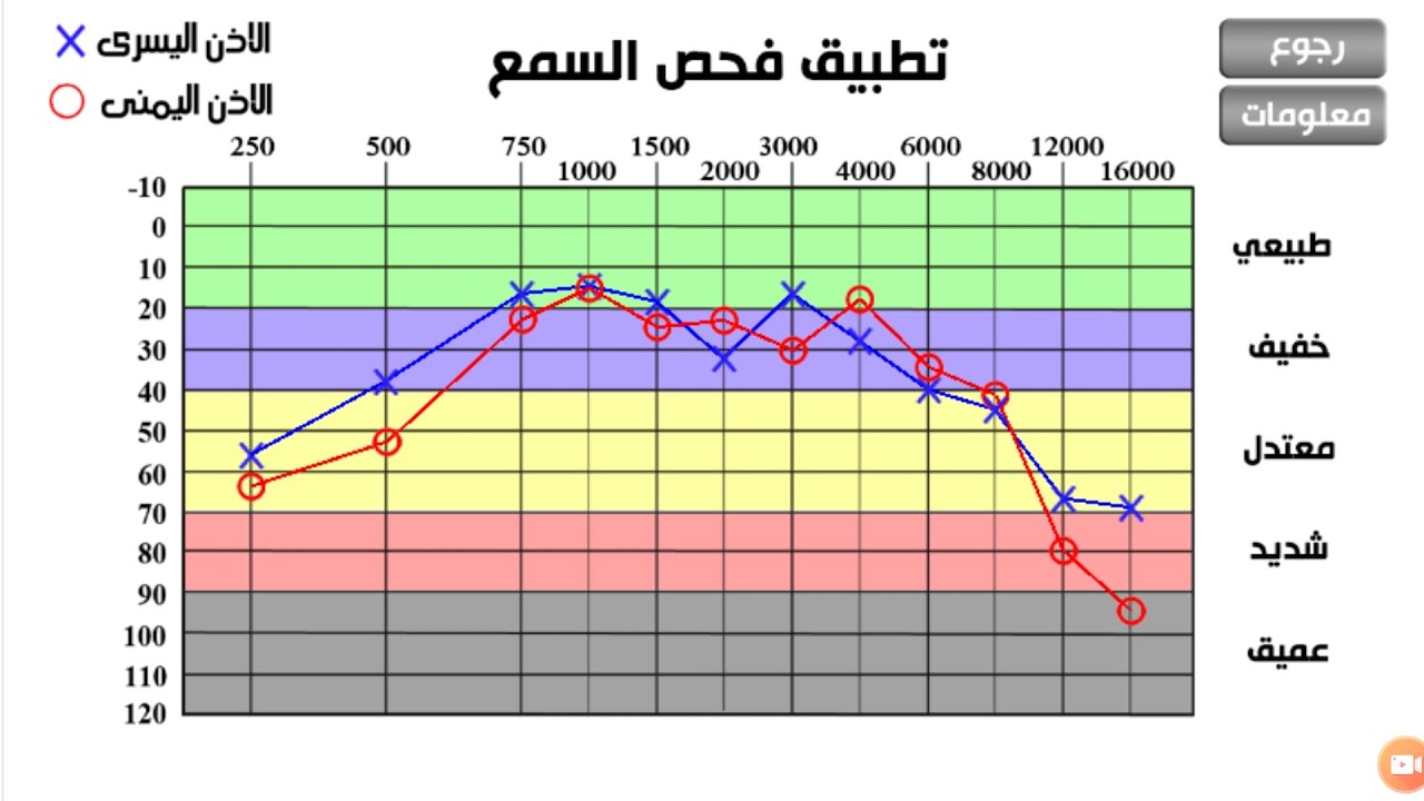 السمع اختبار اختبار السمع