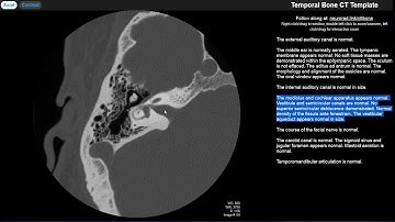 Radiology Walkthroughs - CT Temporal Bone Anatomy