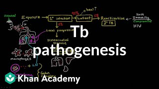 TB pathogenesis | Infectious diseases | NCLEXRN | Khan Academy