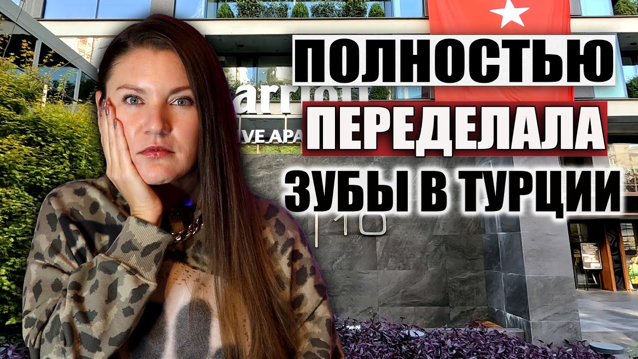 ЧТО ПРОИЗОШЛО С ЗУБАМИ СПУСТЯ ГОД ПОСЛЕ ЛЕЧЕНИЯ В ТУРЦИИ. ТУРЕЦКАЯ СТОМАТОЛОГИЯ МОЙ ОПЫТ
