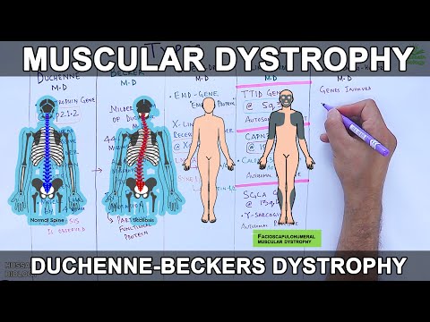 Progressive Muscle Disorder Is Progressive Muscle Relaxation Dangerous With Muscular Dystrophy