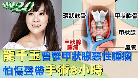 龙千玉曾罹甲状腺恶性肿瘤 怕伤声带手术8小时 健康2.0 - 天天要闻