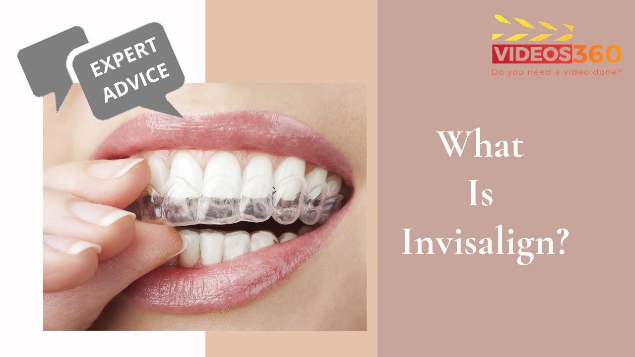 Introducing Invisalign Teen We Consulted