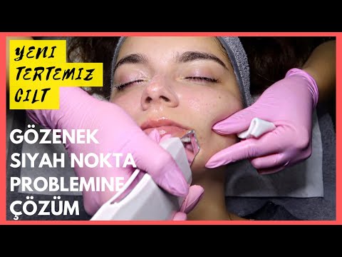 Video: Ultrasonik Yüz Temizleme Makineleri: İçin veya Karşı