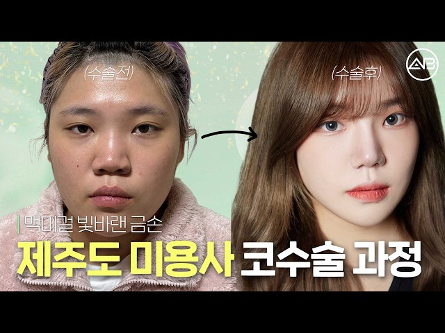 안면윤곽·코성형·지방흡입 후 “저 맞아요?” | 맥미걸 빛바랜 금손 비포애프터🎇 | 에이비성형외과
