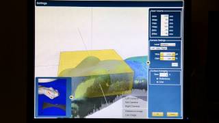 cPosition settings (C-Rad Catalyst HD)