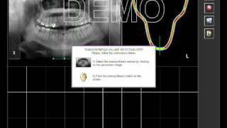 Hyperion Tomografia 3DTS screenshot 4