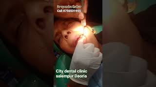 Tooth RCT | Tooth Cleaning | Tooth pain #citydentalclinicsalempur #dentist #dentalclinc