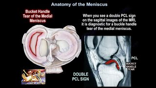 Meniscus TEARS Everything You Need To Know  Dr. Nabil Ebraheim