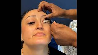 How Different Eye Conditions Change Your Vision 👀