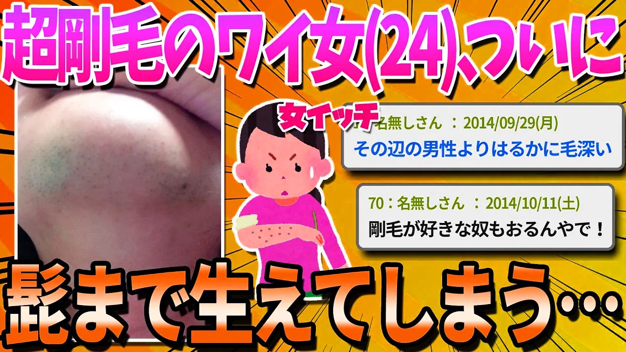 【2ch面白いスレ】超剛毛の女の私が半生を語る【ゆっくり解説】