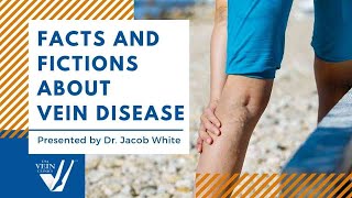"Facts and Fictions About Vein Disease" by Dr. Jacob White [WEBINAR]