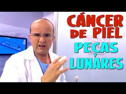 Vídeo: ¿Qué Son Las Pecas? Además, Cuándo Ver A Tu Médico