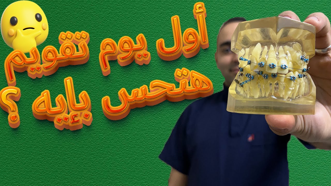 اول يوم تقويم الاسنان | هتحس بإيه مفاجأة؟ | تعليمات تركيب تقويم الاسنان | امتى تكلم الدكتور #braces