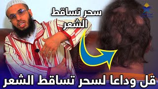 قل وداعا للسحر الذي يعاني منه ملايين الناس ..سحر تساقط الشعر