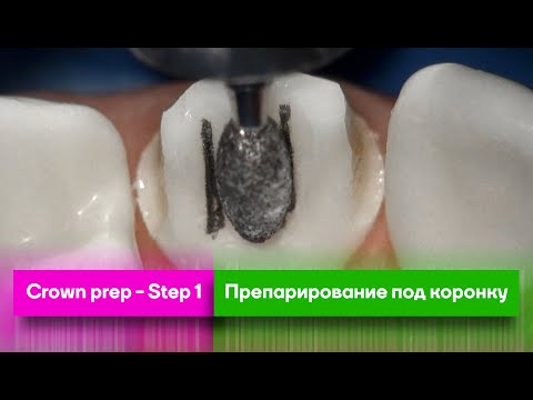 Crown prep - Step 1 / Препарирование под коронку