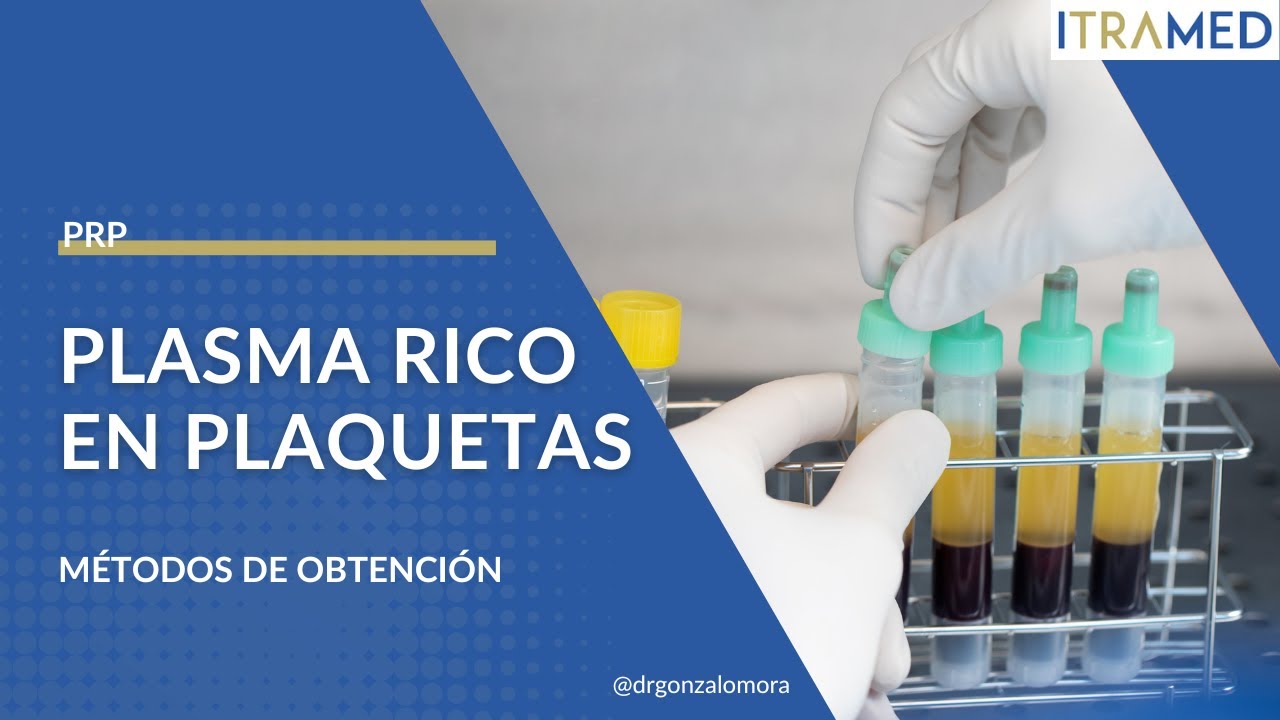Métodos de OBTENCIÓN - Plasma Rico en Plaquetas