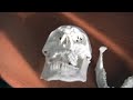 · 醫生用 3D 列印技術為車禍患者重建下頜