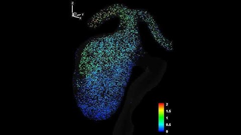 Pulsatile flow in a giant aneurysm III