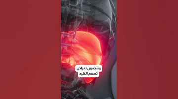أعشاب تسمم الكبد 