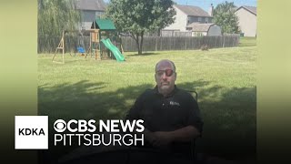 Man shot in the eye on Parkway West says he forgives shooter