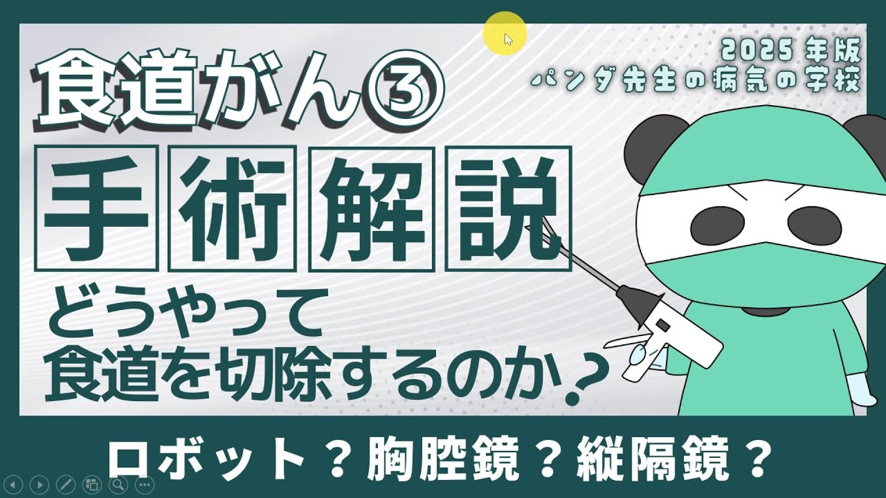 食道がん③手術解説　どうやって食道を切除するのか？【病気の学校2025年版】