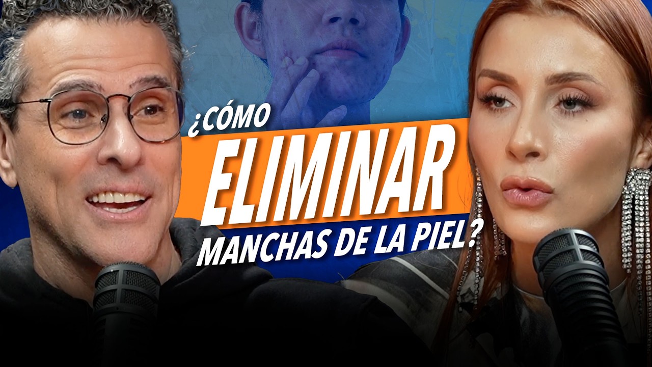 Cómo quitar manchas sin dañar tu piel - Dra.  Karen Carrillo y Marco Antonio Regil