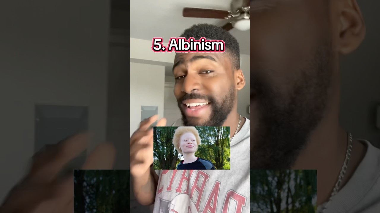 12 Rarest Human Genetics 🧬