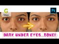 How to remove dark under eyes in Photoshop