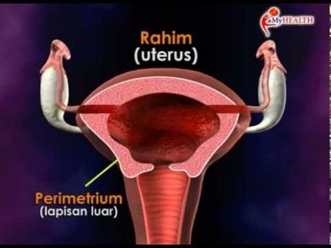 Video: Apakah maksud istilah perubatan cranioschisis?