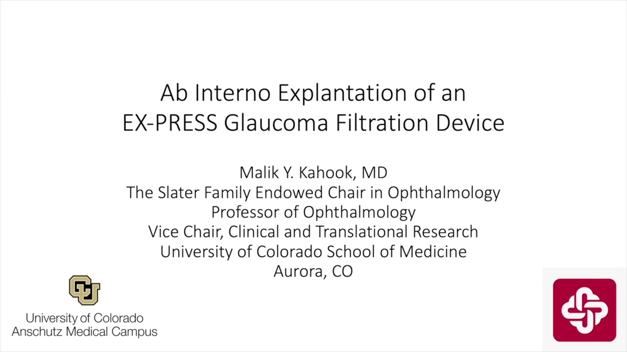 Lecture: Ab Interno Removal of EX-PRESS Device (1 Slide in 5 Minutes)
