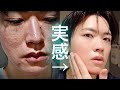 【毛穴 ニキビ】肌が変わったスキンケアルーティン『まとめ』