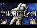 なぜ宇宙飛行士は尿路結石になりやすいのか?【ゆっくり解説】