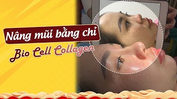 Nâng mũi bằng chỉ Collagen Không phẫu thuật - Đẹp ngay sau làm | BS Tuấn Dương
