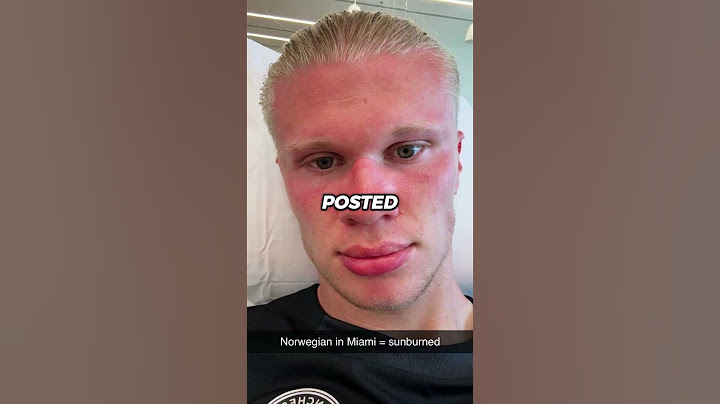 Haaland got sunburned on his first day in America.🤣 Grealish’s reaction to the party without him. 😭💀