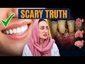 Danton Ki Safai Kyun Zaroori Hai? - 5 Dangerous Diseases Caused by Bad Oral Health!