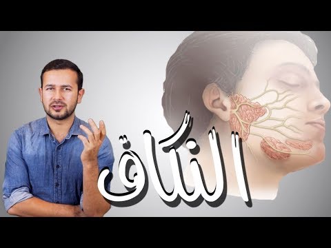 كل ما تحتاج معرفته عن النكاف التهاب الغدة النكافية ابو اللكيم 