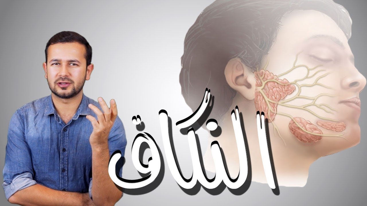 كل ما تحتاج معرفته عن النكاف - التهاب الغدة النكافية - ابو اللكيم - MUMPS